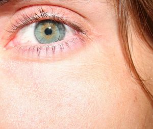 Contact Lens 2291.jpg